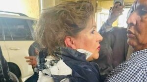 Ονδούρα: Η στιγμή που πετάνε εκρηκτικό μηχανισμό στο κεφάλι βουλευτή!