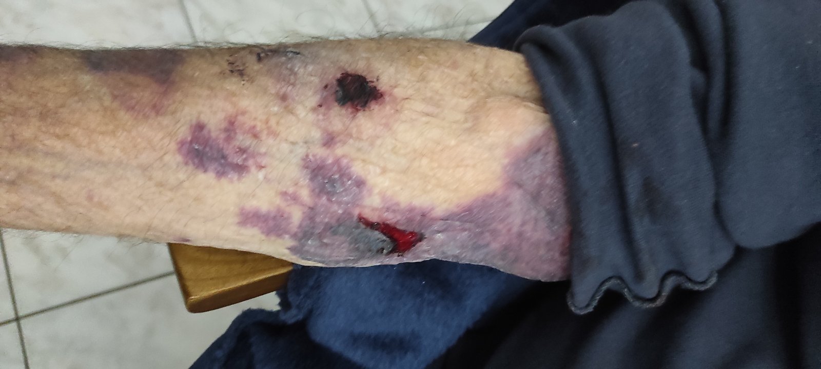 νοσηλεύτρια