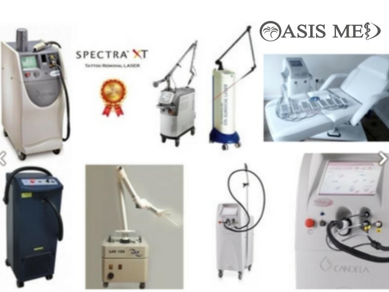 ND yag, V-beam, Fractional Co2, Q-switched 