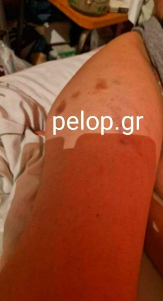 ενδοοικογενειακή βία 