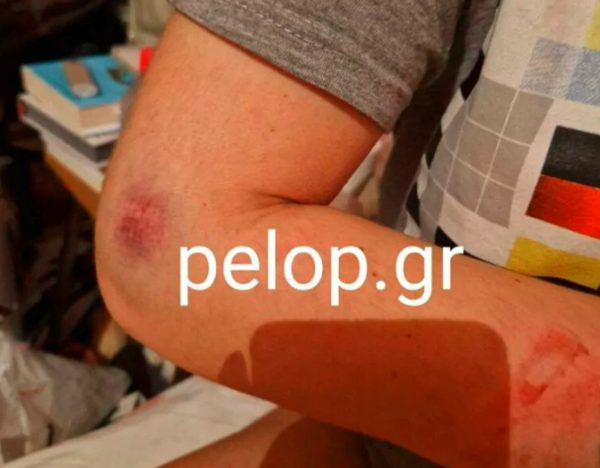 μαχαίρι ενδοοικογενειακή βία