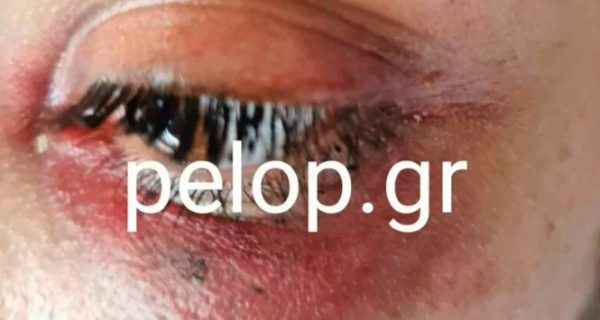 ενδοοικογενειακή βία 