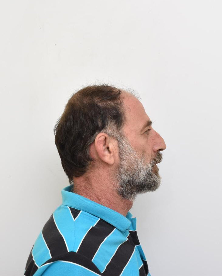 Γιακουμάκης κακοποίηση