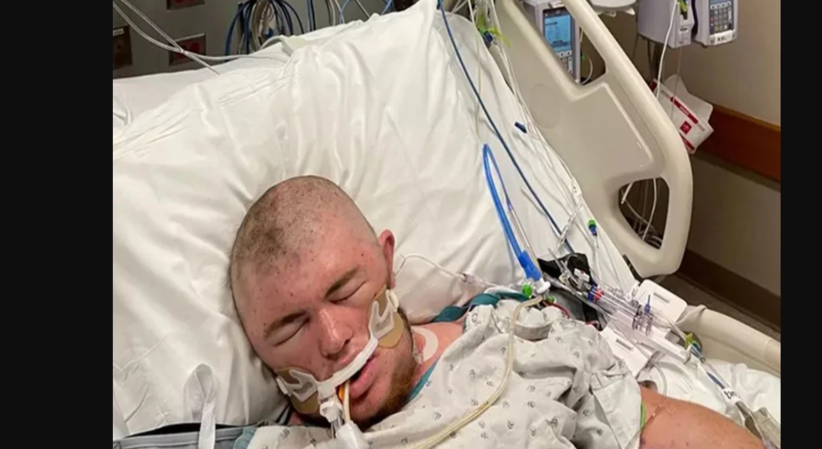 κώμα αμερικανός