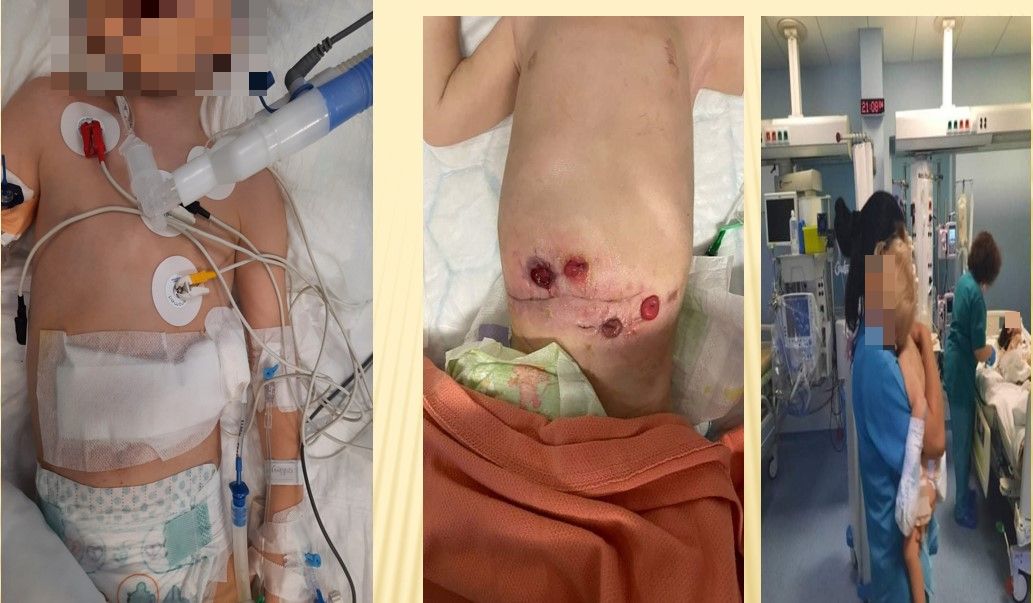 παιδιά νοσοκομείο τροχαία