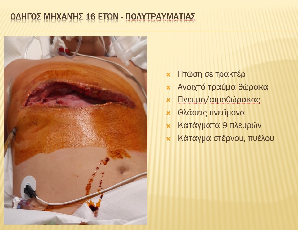 τροχαία παιδιά