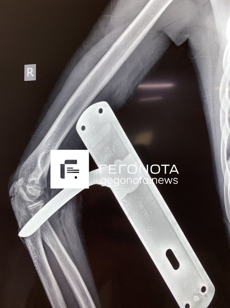 Βόλος πόμολο