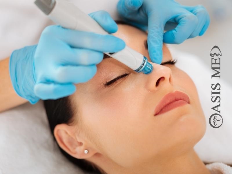 Υδροδερμοαπόξεση