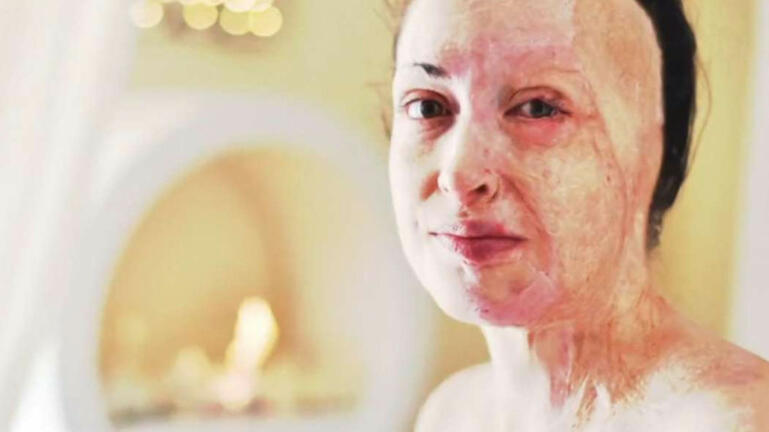 Συγκίνησε η Ιωάννα Παλιοσπύρου: Έδειξε το πρόσωπό της χωρίς τη μάσκα