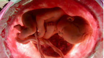  Ασυνήθιστος μηχανισμός φαίνεται πως προστατεύει τα έμβρυα από τον κορωνοϊό