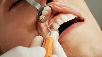 Οδοντίατρος έσπαγε τα δόντια των ασθενών του επίτηδες, για να βάλει θήκες