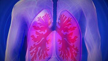 Διπλή μεταμόσχευση πνευμόνων σε ασθενή που έπασχε από καρκίνο στο τελευταίο στάδιο 