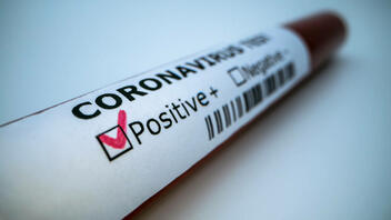«Έξυπνο» βραχιολάκι μπορεί να ανιχνεύσει τον κορωνοϊό πριν από τα συμπτώματα 