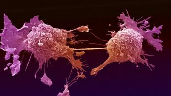 Η θνητότητα από καρκίνο συνεχίζεται να μειώνεται – Τι έδειξε έρευνα
