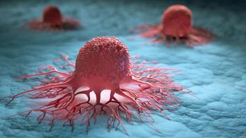 Οι συνωμοσιολόγοι υιοθετούν συχνά μυθικές αιτίες του καρκίνου