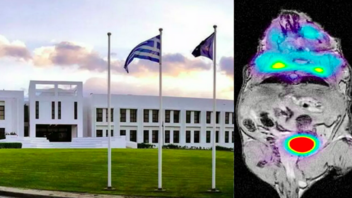 Στο ΙΤΕ η πρώτη εικόνα Ποζιτρονικής-Μαγνητικής Τομογραφίας που παράχθηκε ποτέ στην Ελλάδα