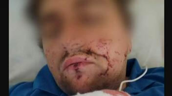 Σοβαρά τραυματισμένος Έλληνας στρατιώτης που πολεμά στο Μπαχμούτ της Ουκρανίας