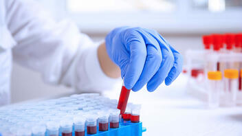 Πολλά υποσχόμενη εξέταση αίματος για τον εντοπισμό δεκάδων τύπων καρκίνου