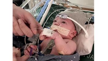 Αναπτύσσεται κανονικά η καρδιά του μωρού που υπεβλήθη στην πρώτη παγκοσμίως μερική μεταμόσχευση - Βίντεο