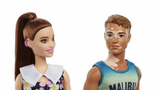 Η Barbie με ακουστικά βαρηκοΐας και ο Ken με λεύκη, με στόχο τη συμπερίληψη