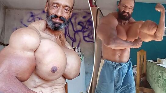 Πέθανε σε ηλικία 55 ετών ο Βραζιλιάνος «Hulk» – Έκανε ενέσεις λαδιού για να «φουσκώσει» τους μύες του
