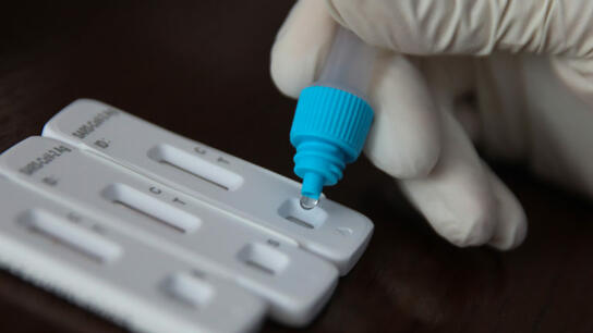 Ο ΕΟΦ ανακαλεί rapid test για κορωνοϊό και γρίπη