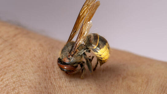 Τσίμπημα από μέλισσα, σφήκα, κουνούπι - Οι Πρώτες Βοήθειες