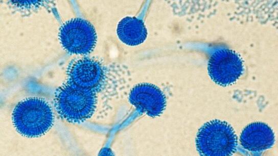 Μελέτη: Οι θάνατοι από μύκητες διπλασιάστηκαν σε μια δεκαετία