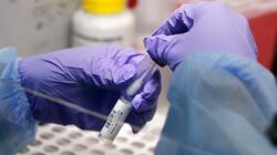 Έρευνα: Απαραίτητες οι ενισχυτικές δόσεις των εμβολίων για την καταπολέμηση της Όμικρον