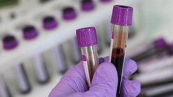 εργαστήριο έρευνα