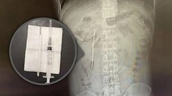 θερμόμετρο