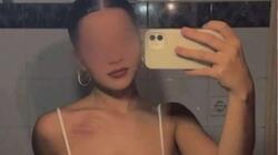 veroia_nekri_katarraktes