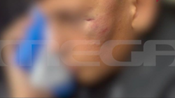 Άγρια επίθεση σε 14χρονο έξω από γυμνάσιο στον Πειραιά