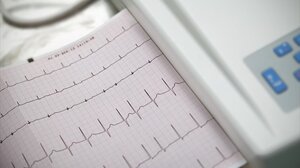 Έρχονται τα SMS για τον δωρεάν καρδιολογικό έλεγχο - Αναλυτικά οι εξετάσεις και οι δικαιούχοι