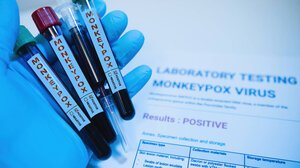 Πρώτο ύποπτο κρούσμα της ευλογιάς των πιθήκων στην Κρήτη