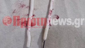 Στο χειρουργείο 13χρονη μετά από χτύπημα που δέχτηκε από τον ίδιο της τον πατέρα