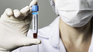 Κορωνοϊός: 43.748 κρούσματα και 154 θάνατοι σε μία εβδομάδα