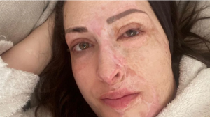 Συγκλονιστική ανάρτηση από την Ιωάννα Παλιοσπύρου– «Ακόμα παλεύω να αποδεχτώ τον νέο μου εαυτό»