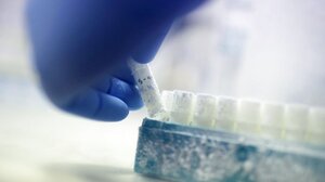 Νέα δωρεά οργάνων: Γιατρός από την Πολωνία έδωσε ζωή με τον θάνατό του!