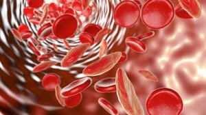 Κατακόρυφη αύξηση των περιστατικών αναιμίας τα τελευταία 30 χρόνια - Τι δείχνει επιστημονική έρευνα