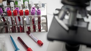 Εξετάσεις αίματος μπορούν να προσδιορίσουν με ακρίβεια τους ασθενείς με long Covid