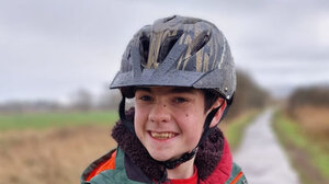 Εμφύτευμα σε εγκέφαλο 13χρονου με επιληψία – Για πρώτη φορά παγκοσμίως