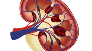 Πέτρα στα νεφρά: Συμβουλές που μειώνουν τον κίνδυνο να αναπτυχθεί