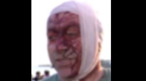 Άνδρας που επιβίωσε από την επίθεση της Χαμάς την 7η Οκτωβρίου 2023, έζησε και το μακελειό στην Αυστραλία