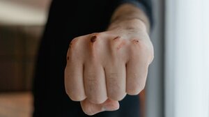 Πάτρα: 16χρονος έδειρε μαθητή δημοτικού επειδή παρενοχλούσε την αδερφή του