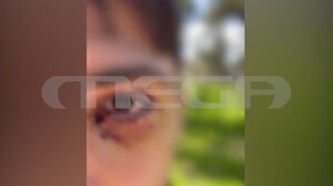 Ιωάννινα: Σοκάρει ο 16χρονος που δέχθηκε άγρια επίθεση από ομάδα ανηλίκων