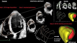 Λογισμικό Ελλήνων επιστημόνων ανιχνεύει καρδιακά προβλήματα 