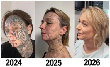 Ολλανδία, Τατουάζ, Κακοποίηση