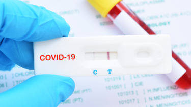 Κορωνοϊός στην Κρήτη: 275 νέα κρούσματα, λέει ο ΕΟΔΥ