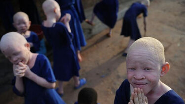 Ένας 4χρονος αλμπίνος βρέθηκε νεκρός και με το σώμα του διαμελισμένο